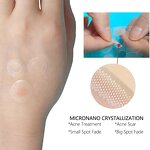 Acne Patches Manufacturer - Hydrocolloid for Early Stage Treatment & Custom Pimple Patch