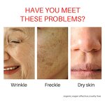 Sleeping Face Mask Manufacturer - Lightly Customized Watermelon Whitening Moisturizing