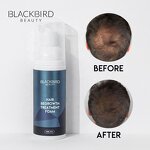 Hair Growth Foam Manufacturer - Private Label Treatment for Hair Regrowth & Thinning