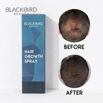 Hair Growth Foam Manufacturer - Private Label Treatment for Hair Regrowth & Thinning
