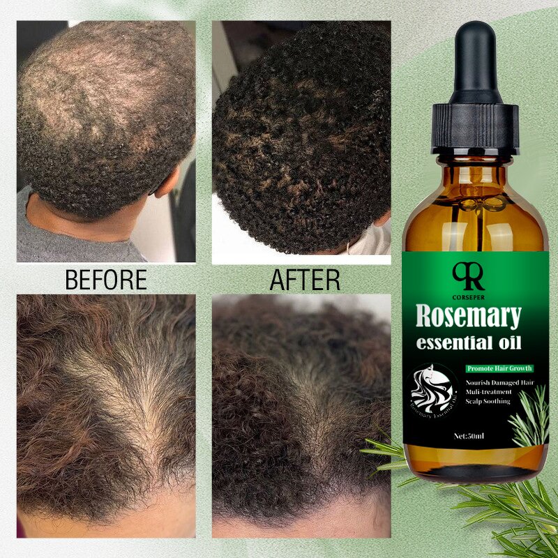 Rosemary Hair Oil Manufacturer - Custom Nourishing Tea Tree Oil Vegan Herbal Care