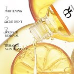 Body Massage Oil Manufacturer - 100% Organic Vitamin C Black Spots Stretch Marks