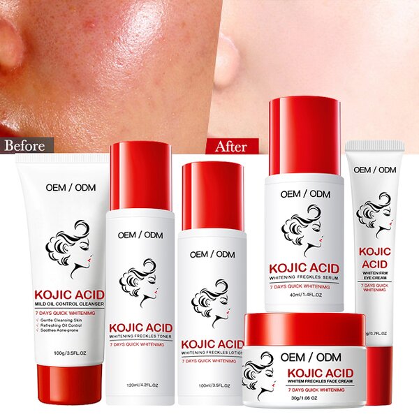 Kojic Acid Skincare Set Manufacturer - Best Selling Face Serum Body Lotion Cream