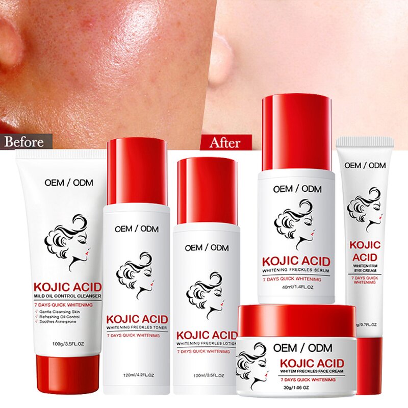 Kojic Acid Skincare Set Manufacturer - Best Selling Face Serum Body Lotion Cream