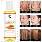 Carrot Essential Oil Manufacturer - Miracle Whitening Moisturizing Body Massage Oil