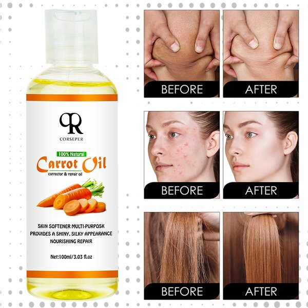 Carrot Essential Oil Manufacturer - Miracle Whitening Moisturizing Body Massage Oil