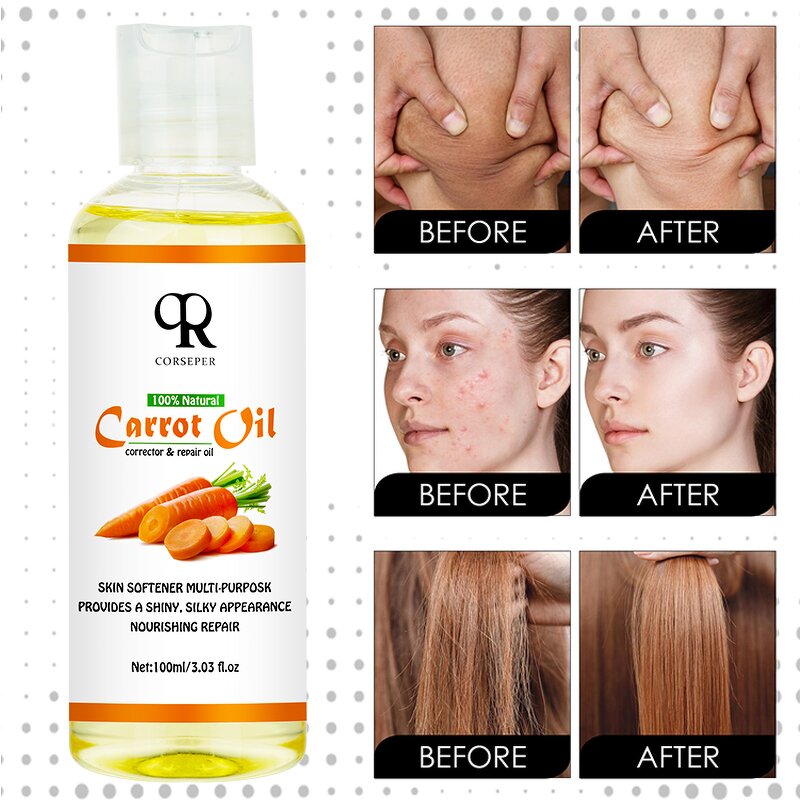 Carrot Essential Oil Manufacturer - Miracle Whitening Moisturizing Body Massage Oil