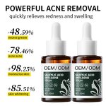 Salicylic Acid Serum Manufacturer - OEM Private Label Anti-Acne Pore Refresher Peeling