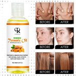 Turmeric Essential Oil Manufacturer - 100ml 7 Days Brighten Hair Skin Even Tone Custom