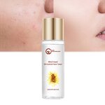 Green Tea Toner Manufacturer - Wholesale Witch Hazel Anti-acne Oil Control Moisturizing