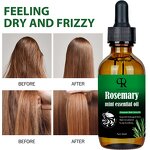 Rosemary Hair Serum Manufacturer - 100% Natural Scalp Elixir Anti Loss Growth Treatment