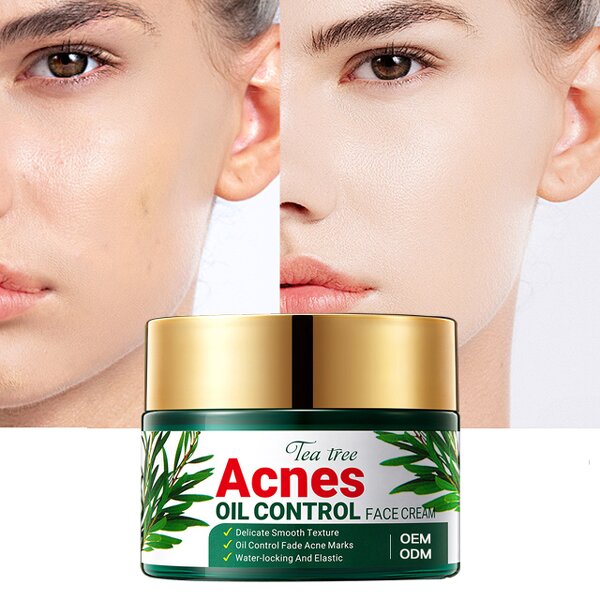 Tea Tree Cream Manufacturer - OEM Private Label Oil Control Acne Treatment Custom