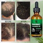 Rosemary Hair Oil Manufacturer - OEM 50ml Fast Strengthening Castor Oil All Hair Types