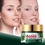 Tea Tree Cream Manufacturer - OEM Private Label Oil Control Acne Treatment Custom
