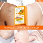 Body Lotion Manufacturer - Vitamin C Turmeric&Retinol Moisturizing Whitening Brightening & SADOER