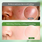 Facial Cleanser Manufacturer - Aloe Soothing Clarifying Moisturizing & BIOAQUA Private Label OEM ODM