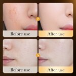 Essence Manufacturer - 24K Gold Collagen with Niacinamide Hyaluronic Acid Moisturizing Brightening Repairing