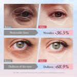 Eye Cream Manufacturer - Firming Tightening Dark Circles Removal Brightening Anti Wrinkle 4 in 1 Roller & SADOER
