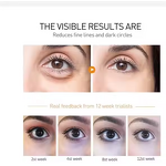 Eye Cream Manufacturer - Retinol Elastic Hydrating with Vitamin C Anti-Wrinkle Firming & OEM J1