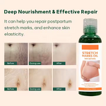 Scar Removal Cream Manufacturer - Organic Skin Revitalizer Stretch Mark Firming Postpartum Oil & Own Brand