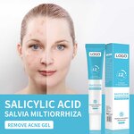 Treatment Cream Manufacturer - Fast Effective Repair Pimple Scar Anti Spots Gel Shrink Pores