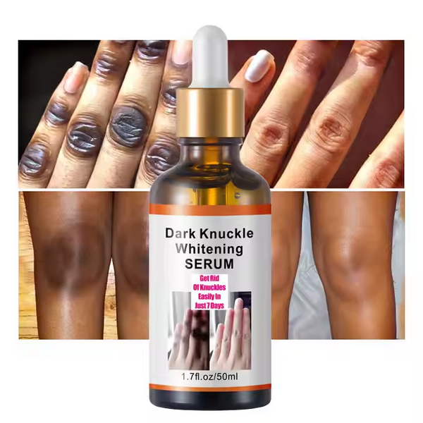 Whitening Serum Manufacturer - Knuckle Quick Glycerin-Infused Pigmentation Correction for Body & Own Brand