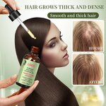 Essential Oil Manufacturer - High Quality Custom Organic Rosemary for Hair Growth Moisturizing Smoothing & OEM ODM Factory