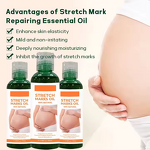 Scar Removal Cream Manufacturer - Organic Skin Revitalizer Stretch Mark Firming Postpartum Oil & Own Brand