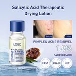 Skin Care Set Manufacturer - Natural Organic Liquid Acne Serum for Oil Control Deep Cleansing & OEM ODM Factory