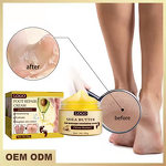Foot Repair Cream Manufacturer - for Thick Rough Cracked Skin and Calluses