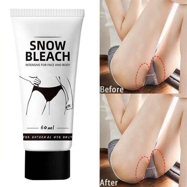 Bleaching Cream Manufacturer - for Face Body Whitening Dark Knuckles Elbows Underarms Private Areas