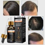 Hair Oil Serum Manufacturer - All Natural Coconut Formula Nourishes Scalp Increases Volume & OEM Factory