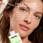Face Lotion Manufacturer - with Salicylic Acid for Oil Control Acne Removal Desalination Moisturizing