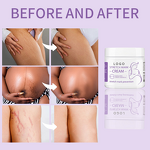 Scar Removal Cream Manufacturer - Organic Vegan for Stretch Mark with Shea Butter & Private Label