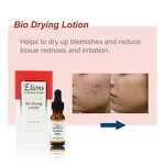 Vitamin A Drying Lotion Manufacturer - Bio Acne Herbal Oil-Free Paraben-Free OEM Anti-Acne