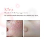 Arbutin Niacinamide Cream Manufacturer - Private Label 2% Vitamin C Anti-Pigmentation Dark Spot