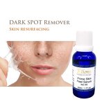 Skin Peeling Serum Manufacturer - 50% Acid Dark Knuckles Finger Joints Reduce Black Skin