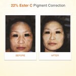 Vitamin C E Serum Manufacturer - High-Potency Anti-Aging Whitening OEM/ODM Private Label