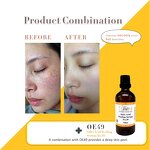 Exfoliating Peeling Gel Manufacturer - 50% Sugar Cane Acid Whitening Pore Shrinking Anti-Acne