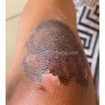 Peeling Solution Manufacturer - Private Label 50% Liquid Anti-Wrinkle Whitening for Black Skin