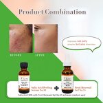 Professional Peeling Set Manufacturer - Medium Depth Renewing Anti-Aging Acne Whitening