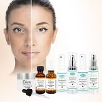Treatment Beauty Set
