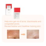 BHA Acne Remover Serum Manufacturer - Argan Oil Tea Tree Eliminates Clogged Pores