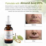 Mandelic Acid Serum Manufacturer - 20% Tranexamic Acid Anti-Aging Anti-Acne Pigmentation