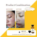 AHA Exfoliator Serum Manufacturer - 50% Anti-Acne Blackhead Whitening Dark Spot Anti-Aging