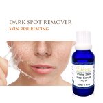 Chemical Face Peel Manufacturer - 30% Acid 30ml Pigmentation Whitening Anti-Wrinkle Stretch Marks