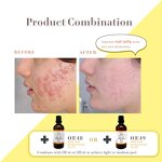 AHA Peeling Gel Manufacturer - 35% Dark Spot Corrector Blackhead Renewing Brightening Anti-Aging