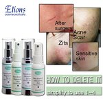 Skin Peeling Kit Manufacturer - AHA 50% Salix Acid 30% Anti Scar Super Whitening Set