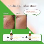 BHA Peeling Serum Manufacturer - 30% Salix Acid Anti-Acne Blackhead Dark Spot Exfoliating