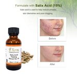 Salix Acid Peeling Serum Manufacturer - 15% Gel Anti-Acne Whitening Pore Shrinking OEM